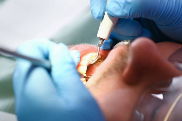 Best Emergency TMJ Treatment in Lincoln Village, OH