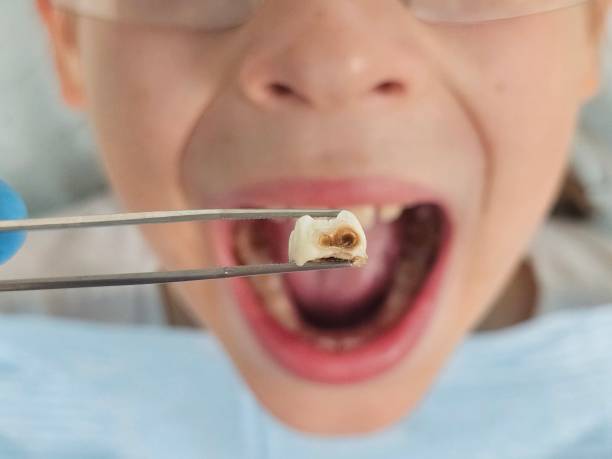 Best Emergency TMJ Treatment in Lincoln Village, OH